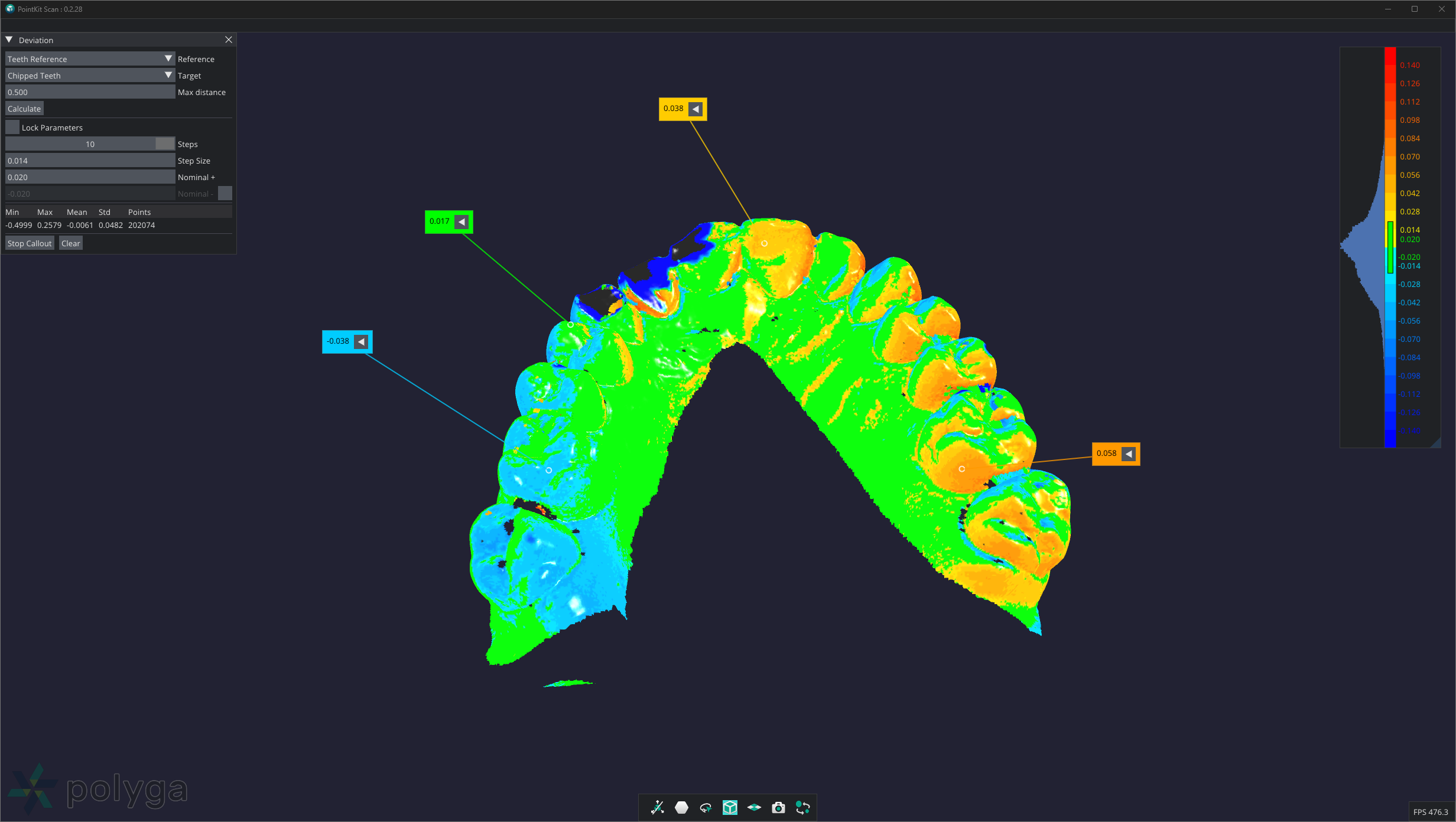 The 3D measurement of the teeth in PointKit Scan app for metrology application